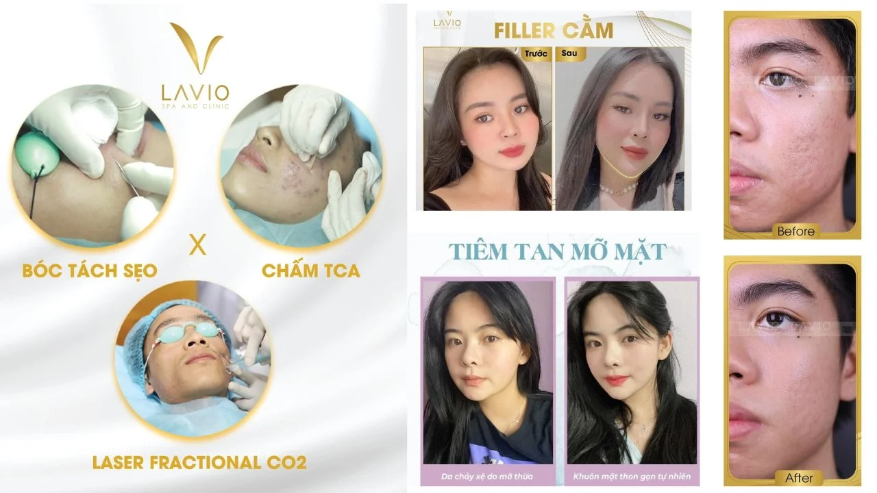 LAVINO Spa Cần Thơ